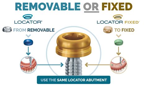 what is a locator metal housing|locator core abutment attachment.